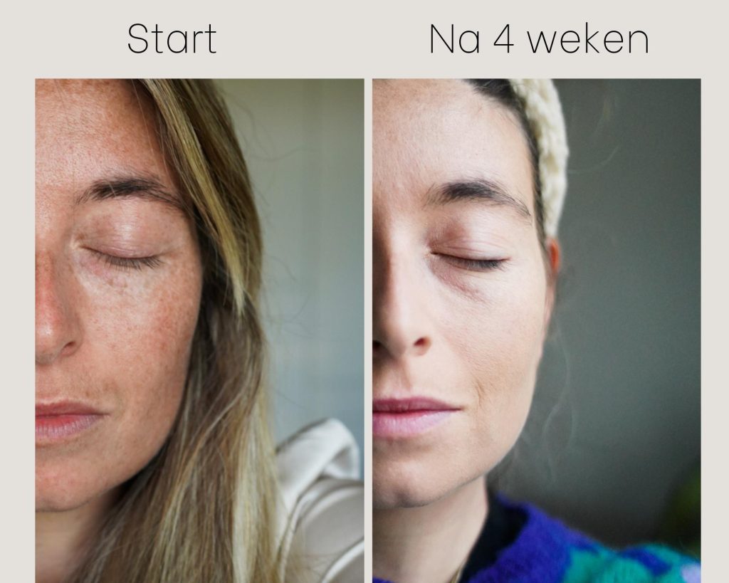 Pigmentvlekken verwijderen NIVEA Luminous routine